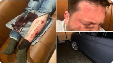 Late Russian leader Navalny's aide Volkov attacked with hammer in Lithuania