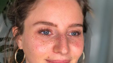 Are TikTok’s new trend freckle tattoos a step too far? Read what medical professionals have to say