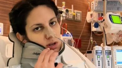 What is dysphagia? Texas woman reveals horrific health scare after botox injections