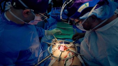 In a first, US surgeons successfully transplants genetically-edited pig kidney into 62-year-old patient