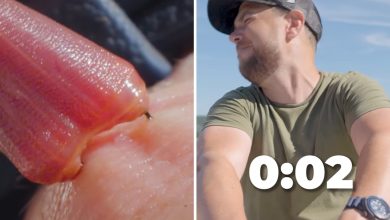 MIT grad willingly puts hand in box filled with venomous bloodworms: ‘Why would you do that?’